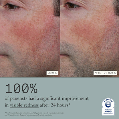 Final 3 Hours: 60%OFF🔥Skin Mercy Recovery Cream